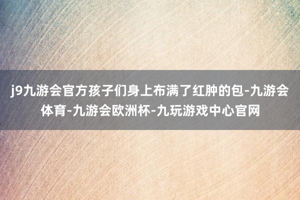 j9九游会官方孩子们身上布满了红肿的包-九游会体育-九游会欧洲杯-九玩游戏中心官网